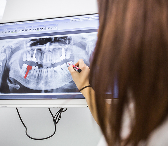 Marking an X ray with dental implant highlighted