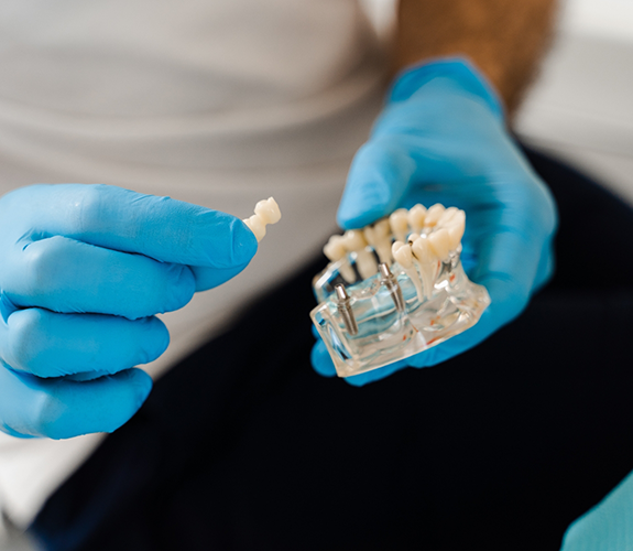 Holding plastic model with dental implants and a bridge